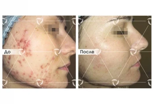 клиника лазерной косметологии линлайн фото 6 - tattooo.ru