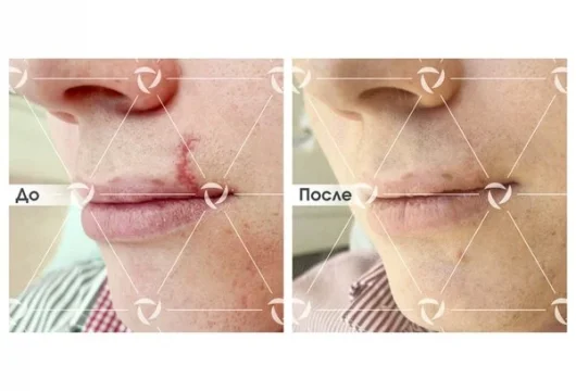 клиника лазерной косметологии линлайн фото 2 - tattooo.ru