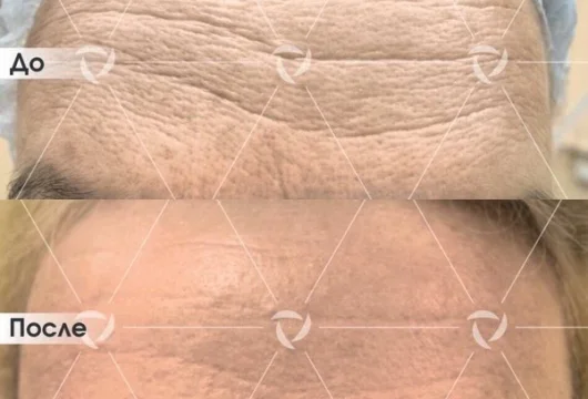 клиника лазерной косметологии линлайн фото 7 - tattooo.ru