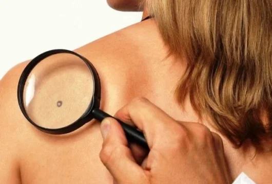 клиника безопасной косметологии white beauty clinic фото 8 - tattooo.ru