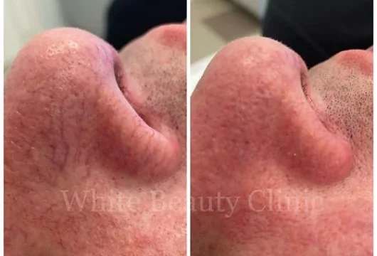 клиника безопасной косметологии white beauty clinic фото 3 - tattooo.ru